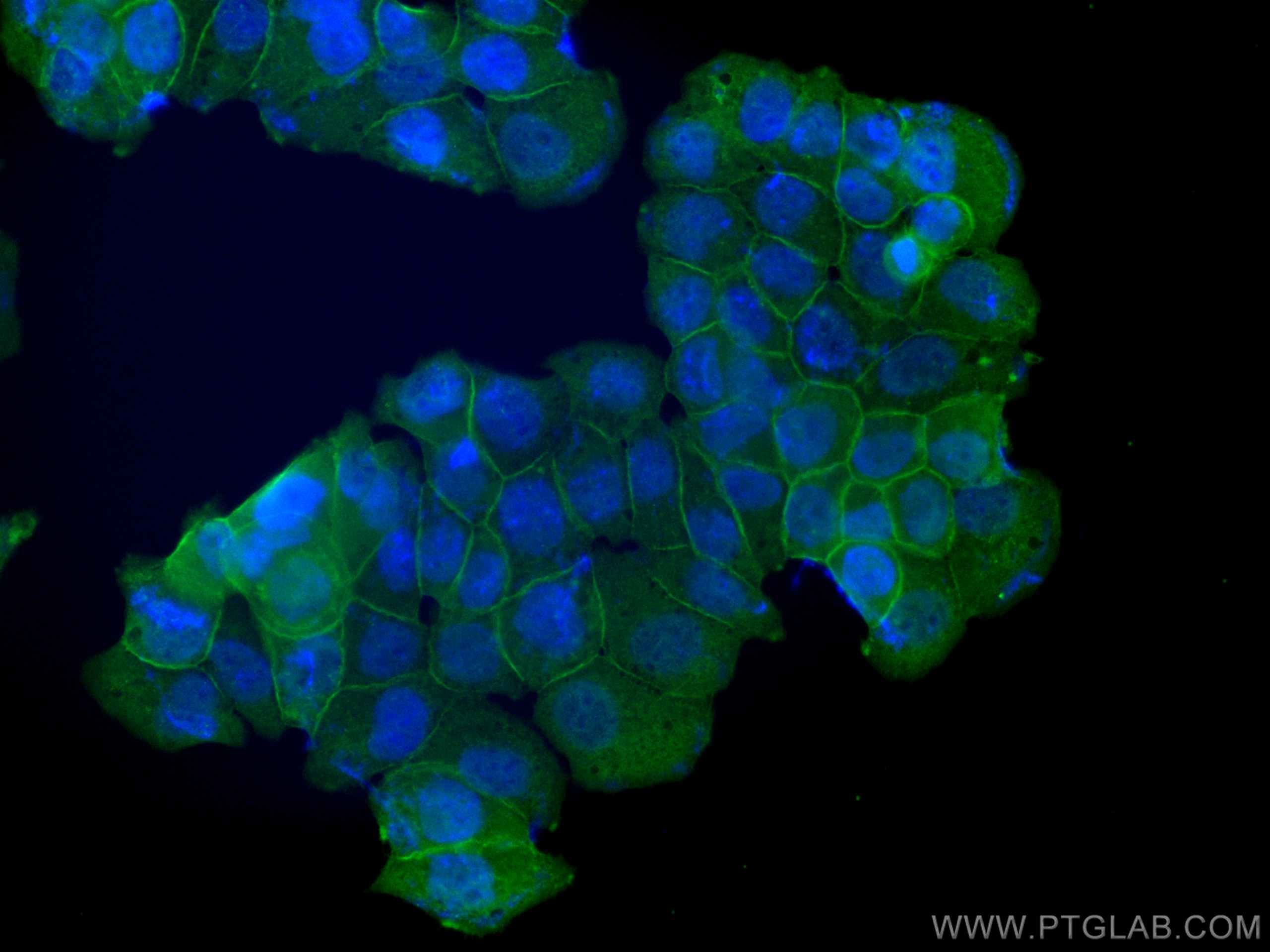 Immunofluorescence (IF) / fluorescent staining of T-47D cells using Annexin A2 Polyclonal antibody (11256-1-AP)