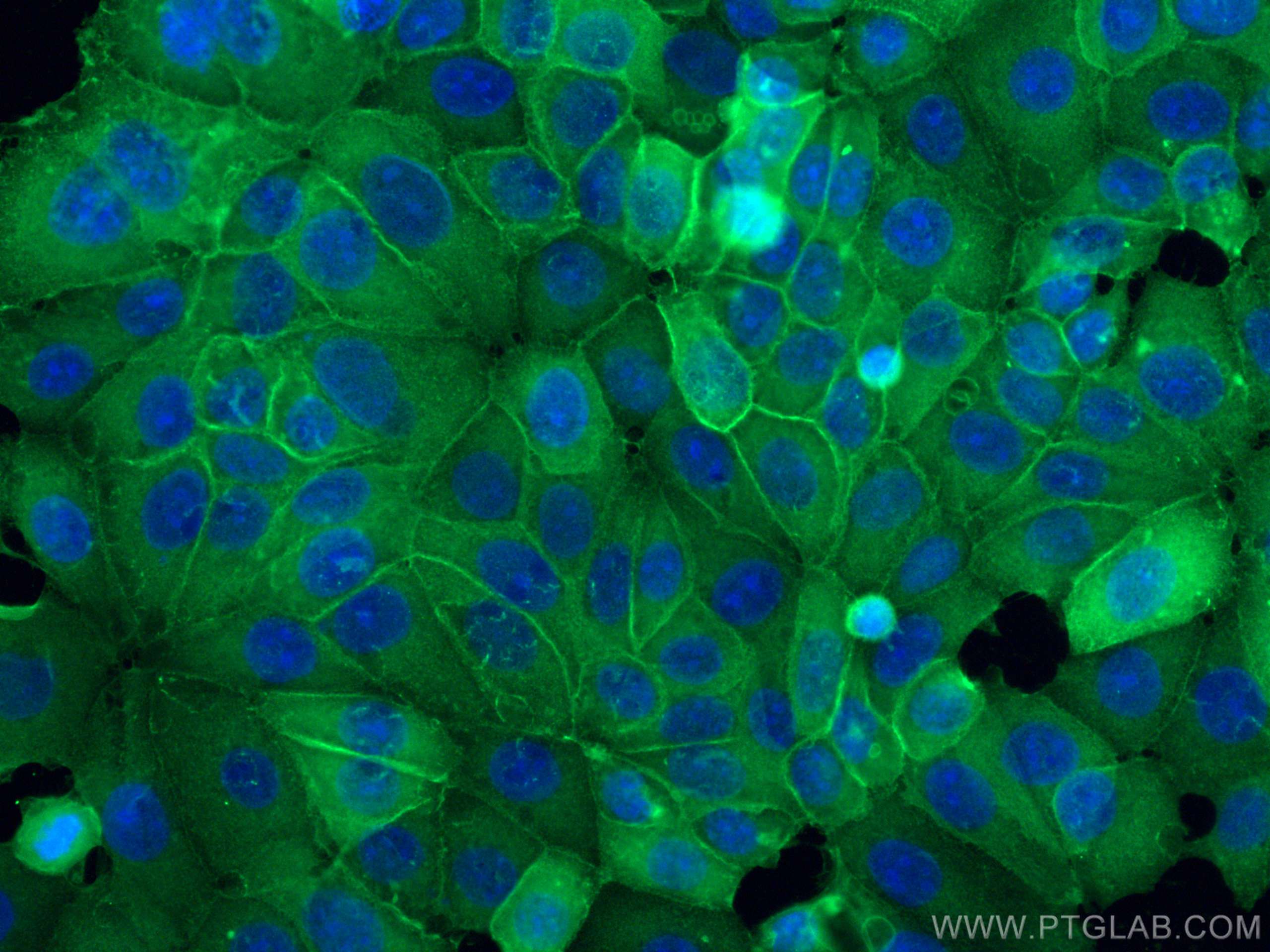 Immunofluorescence (IF) / fluorescent staining of MCF-7 cells using Annexin A2 Polyclonal antibody (11256-1-AP)