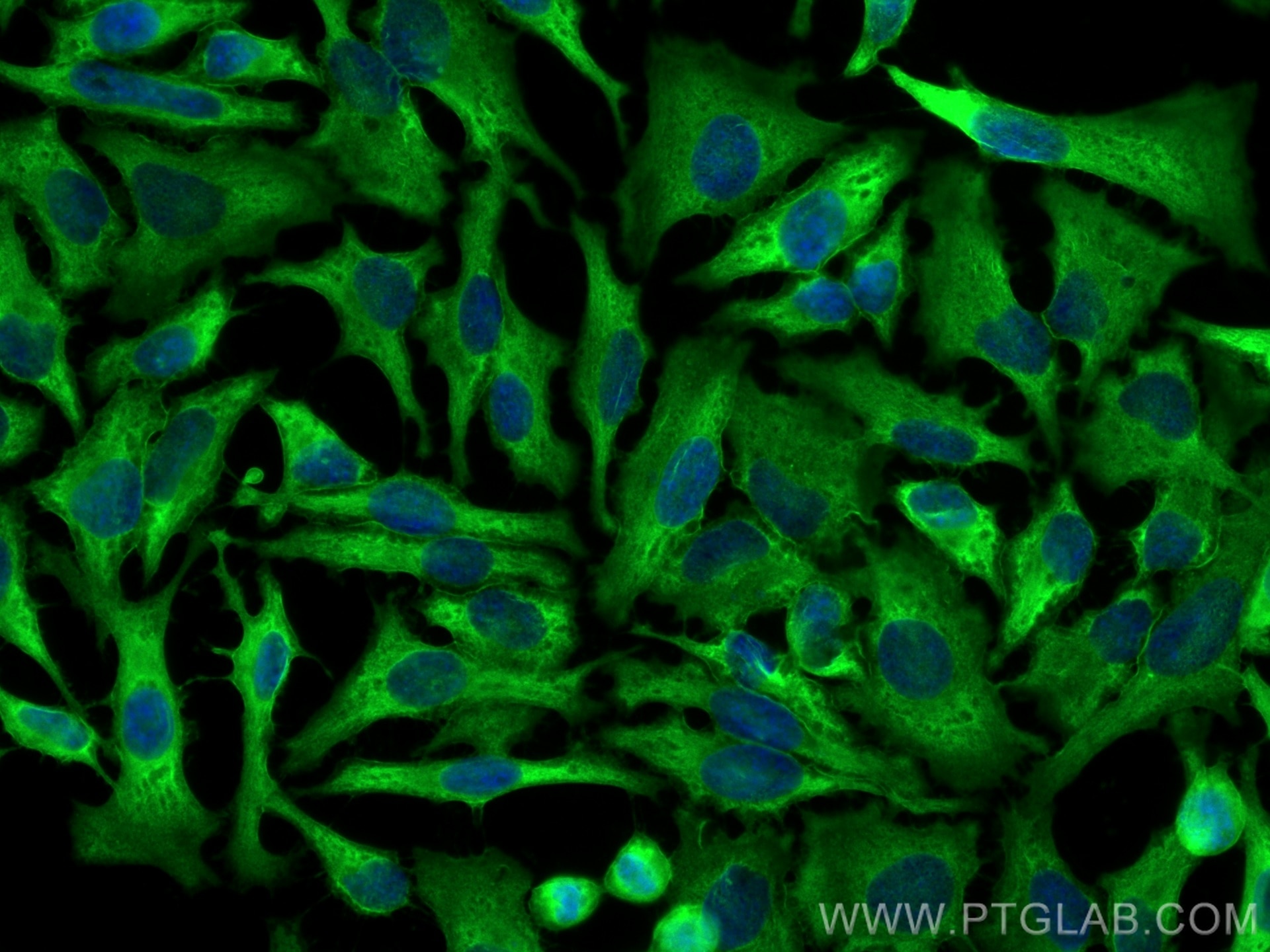 Immunofluorescence (IF) / fluorescent staining of HeLa cells using Annexin A2 Polyclonal antibody (11256-1-AP)