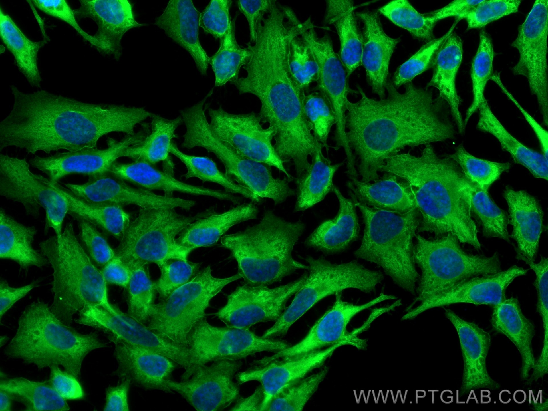 Immunofluorescence (IF) / fluorescent staining of HeLa cells using Annexin A2 Polyclonal antibody (11256-1-AP)