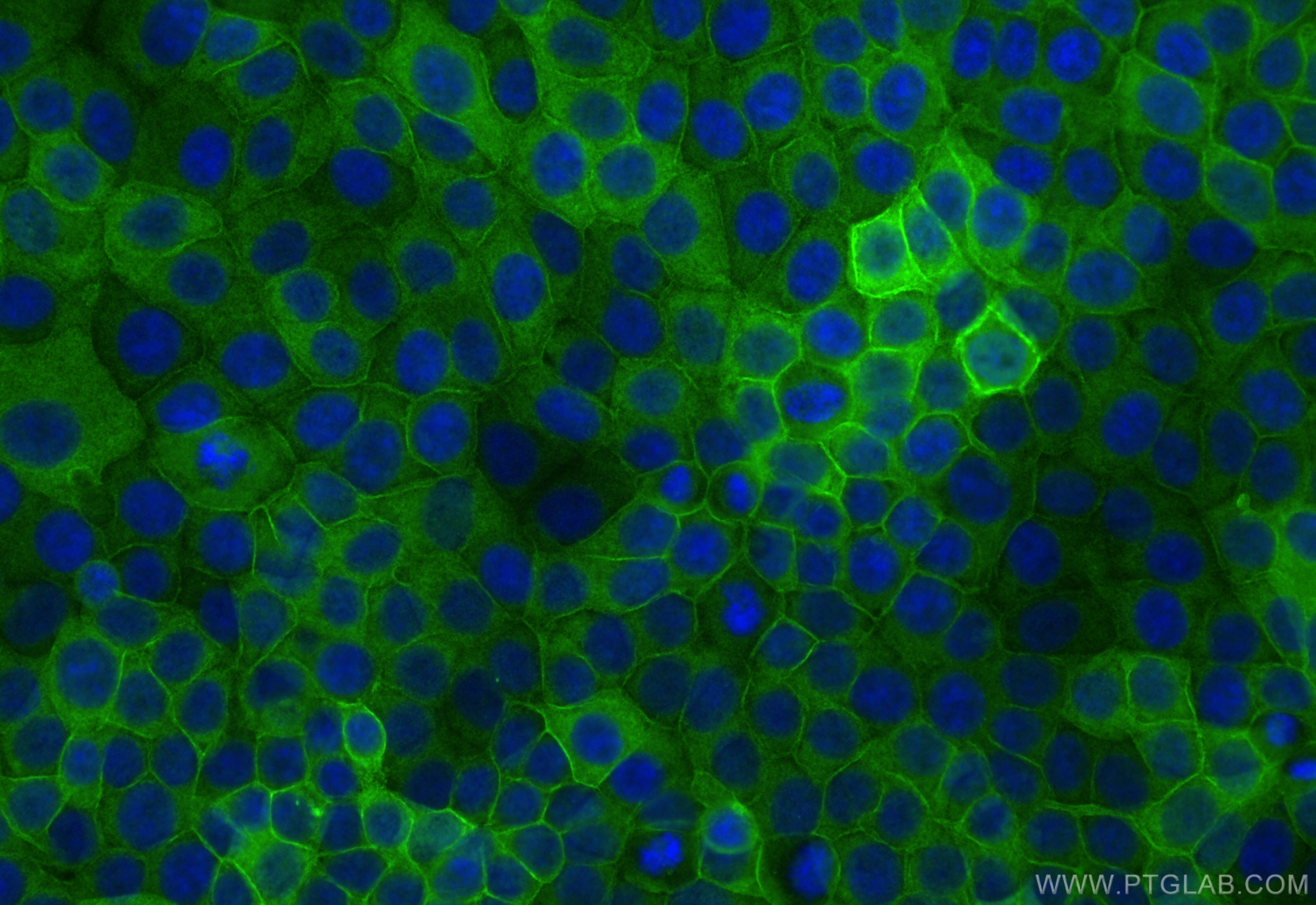 Immunofluorescence (IF) / fluorescent staining of MCF-7 cells using Annexin A2 Polyclonal antibody (11256-1-AP)