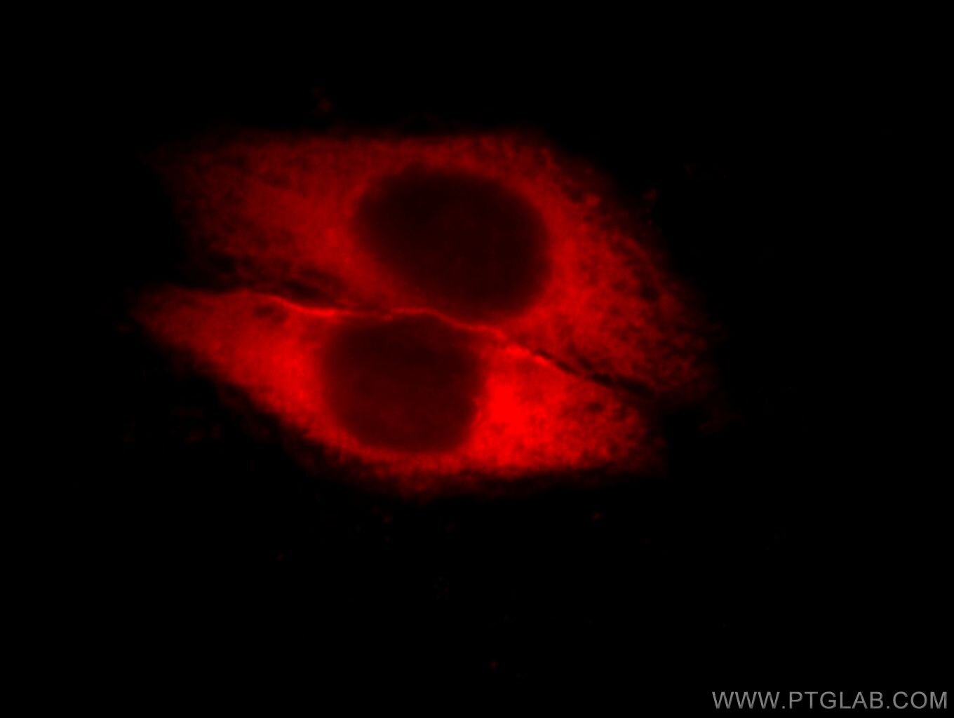 Annexin A2 Polyclonal antibody