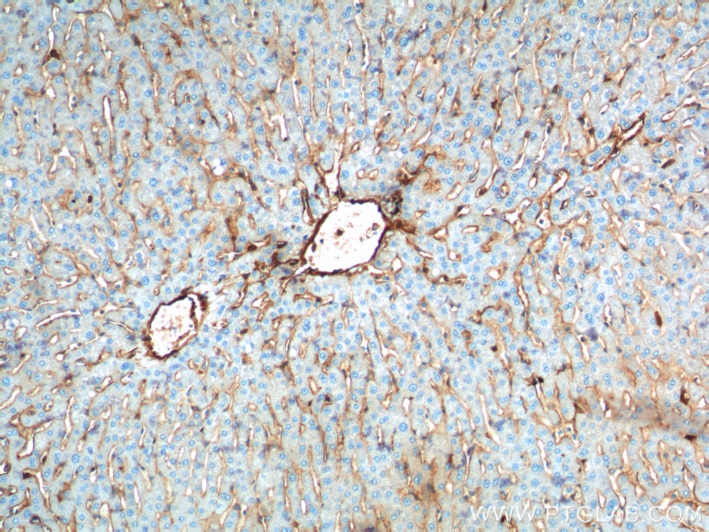 Immunohistochemistry (IHC) staining of human liver tissue using Annexin A2 Polyclonal antibody (11256-1-AP)