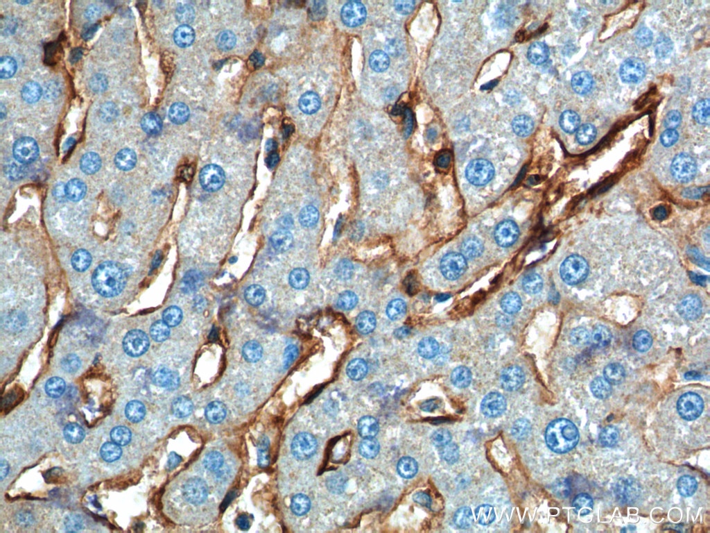 Immunohistochemistry (IHC) staining of human liver tissue using Annexin A2 Polyclonal antibody (11256-1-AP)