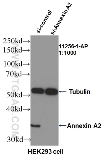 Western Blot (WB) analysis of HEK-293 cells using Annexin A2 Polyclonal antibody (11256-1-AP)