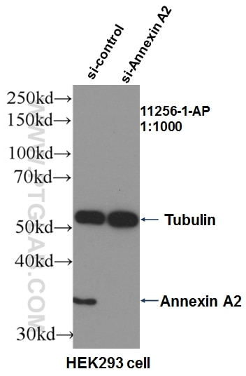 WB analysis of HEK-293 using 11256-1-AP