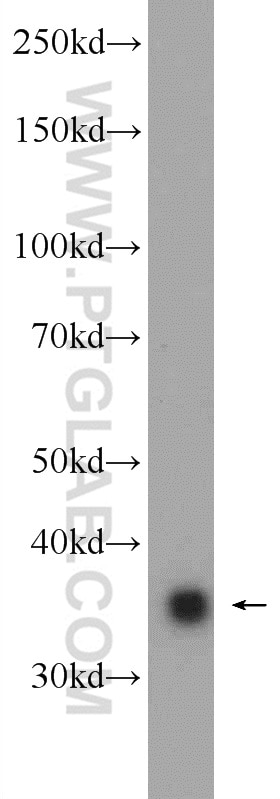 Western Blot (WB) analysis of mouse placenta tissue using Annexin A2 Polyclonal antibody (11256-1-AP)