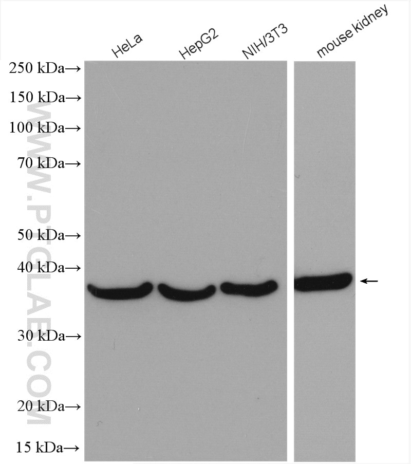 Western Blot (WB) analysis of various lysates using Annexin A2 Polyclonal antibody (11256-1-AP)