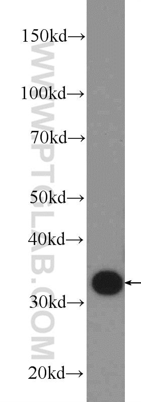 Western Blot (WB) analysis of rat uterus tissue using Annexin A2 Polyclonal antibody (11256-1-AP)