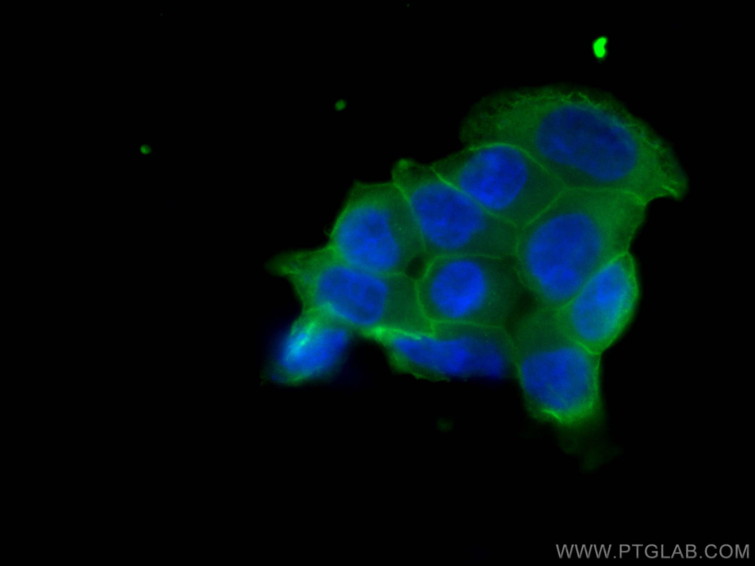 Immunofluorescence (IF) / fluorescent staining of T-47D cells using Annexin A2 Monoclonal antibody (60051-1-Ig)