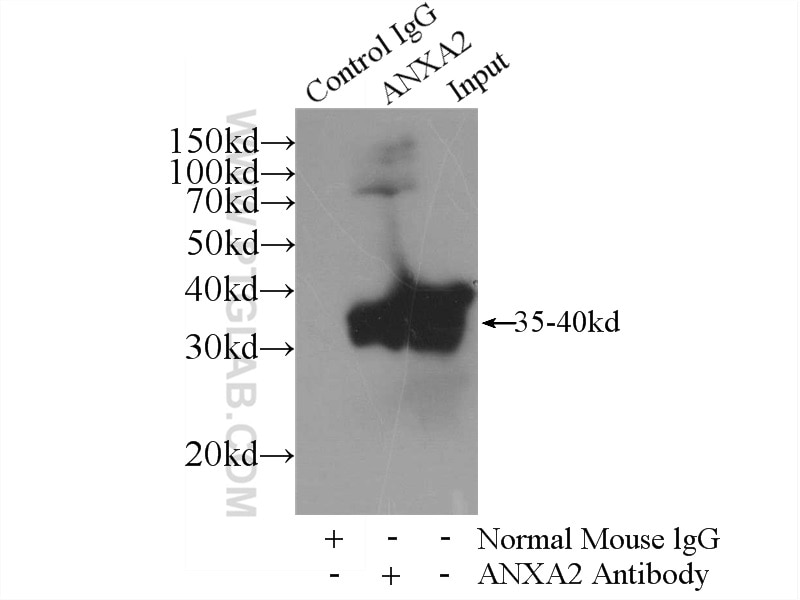 Immunoprecipitation (IP) experiment of HeLa cells using Annexin A2 Monoclonal antibody (60051-1-Ig)