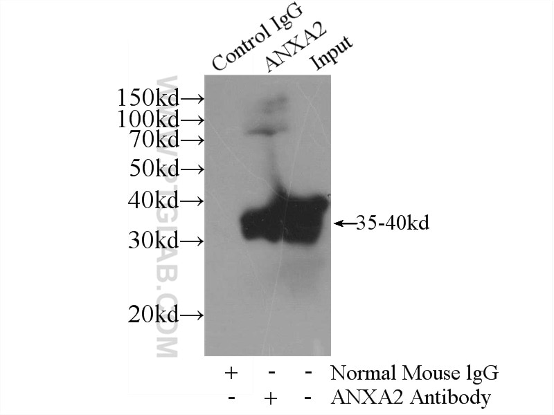 IP experiment of HeLa using 60051-1-Ig