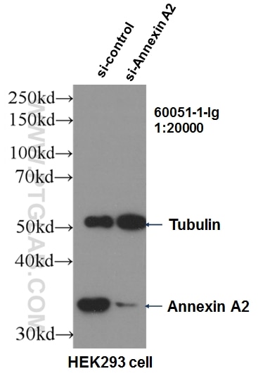 WB analysis of HEK-293 using 60051-1-Ig