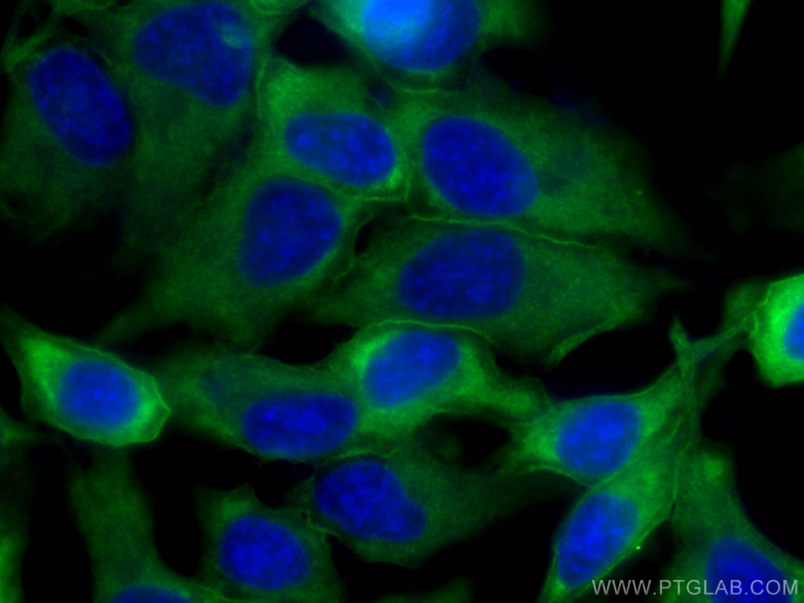 Immunofluorescence (IF) / fluorescent staining of HeLa cells using Annexin A2 Monoclonal antibody (66035-1-Ig)