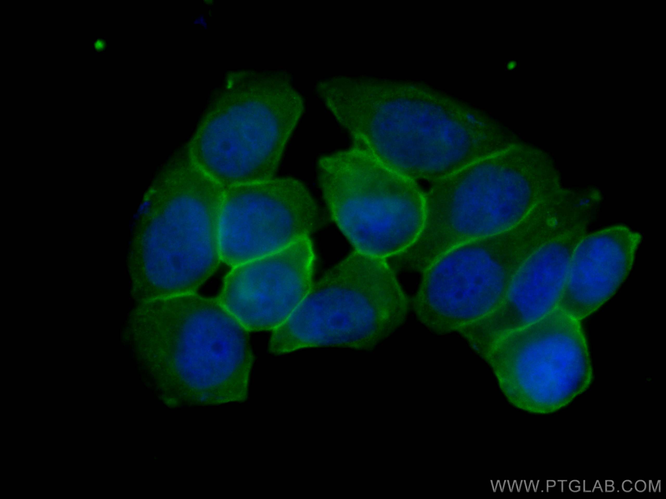 Immunofluorescence (IF) / fluorescent staining of T-47D cells using Annexin A2 Monoclonal antibody (66035-1-Ig)