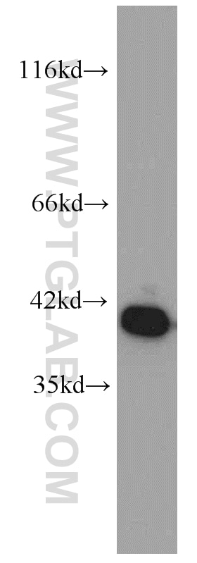 Western Blot (WB) analysis of human brain tissue using Annexin A2 Monoclonal antibody (66035-1-Ig)