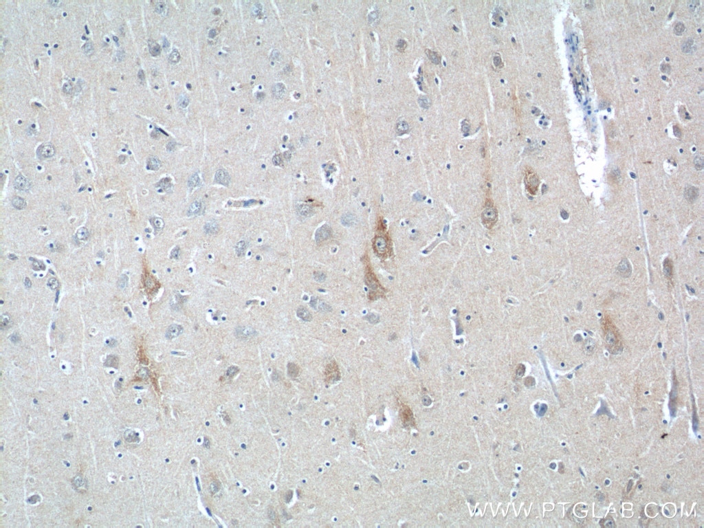 Immunohistochemistry (IHC) staining of human brain tissue using ANXA2R Polyclonal antibody (23838-1-AP)