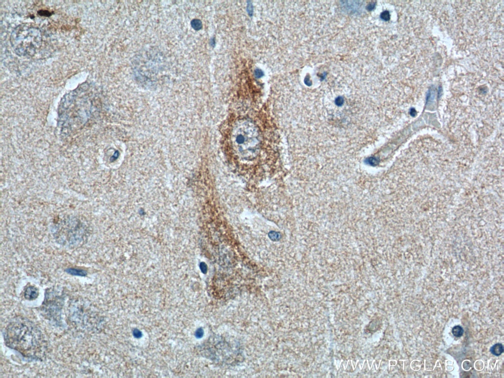 Immunohistochemistry (IHC) staining of human brain tissue using ANXA2R Polyclonal antibody (23838-1-AP)