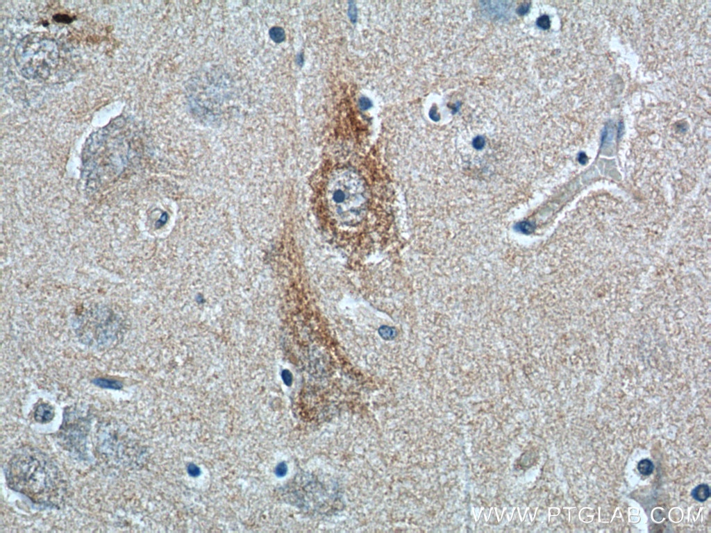 Immunohistochemistry (IHC) staining of human brain tissue using ANXA2R Polyclonal antibody (23838-1-AP)