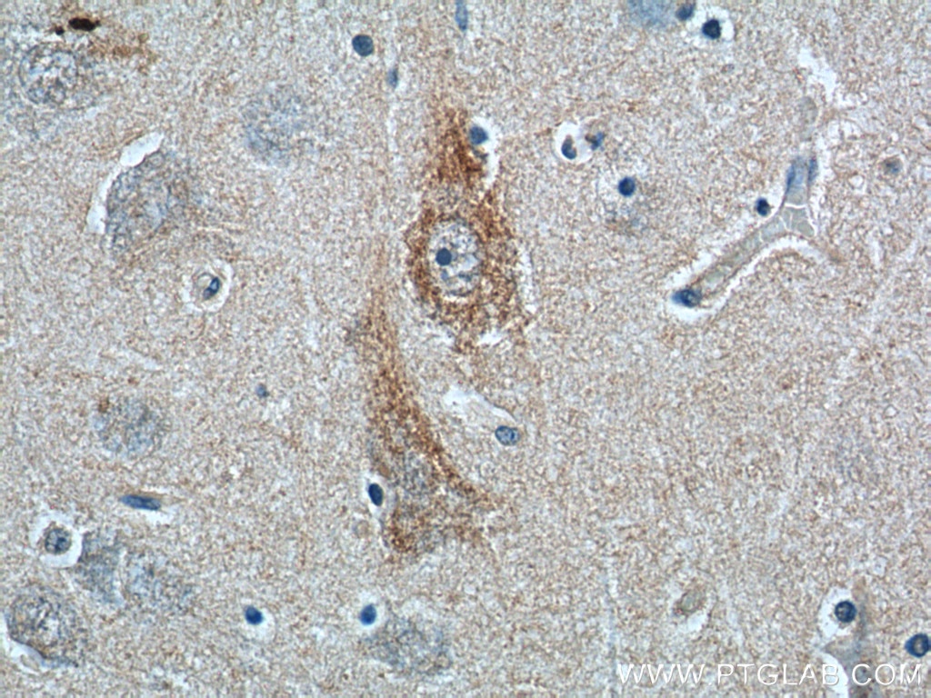 IHC staining of human brain using 23838-1-AP