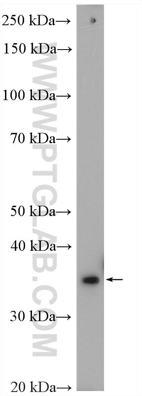 Western Blot (WB) analysis of human testis tissue using Annexin A3 Polyclonal antibody (11804-1-AP)