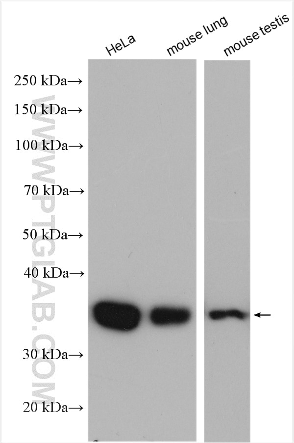 Western Blot (WB) analysis of various lysates using Annexin A3 Polyclonal antibody (11804-1-AP)