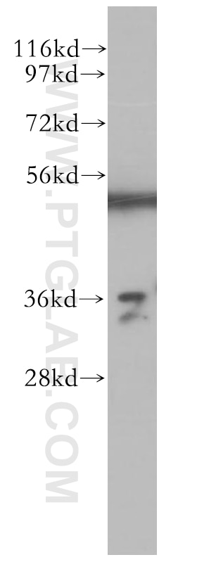 Western Blot (WB) analysis of human brain tissue using Annexin A3 Polyclonal antibody (11804-1-AP)