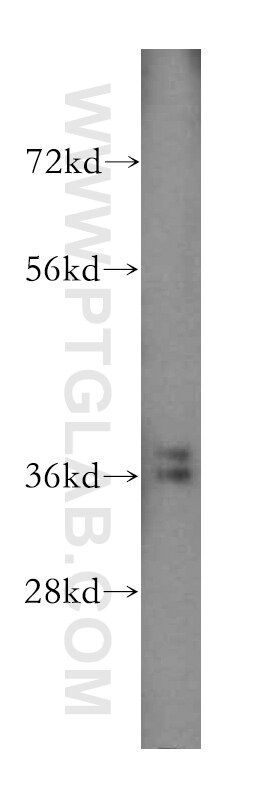 Western Blot (WB) analysis of HEK-293 cells using Annexin A3 Polyclonal antibody (11804-1-AP)