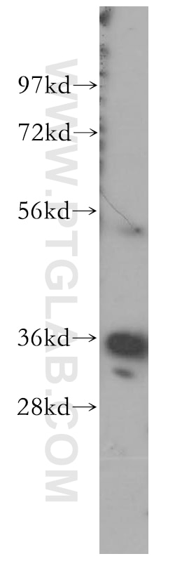 Western Blot (WB) analysis of human liver tissue using Annexin A3 Polyclonal antibody (11804-1-AP)