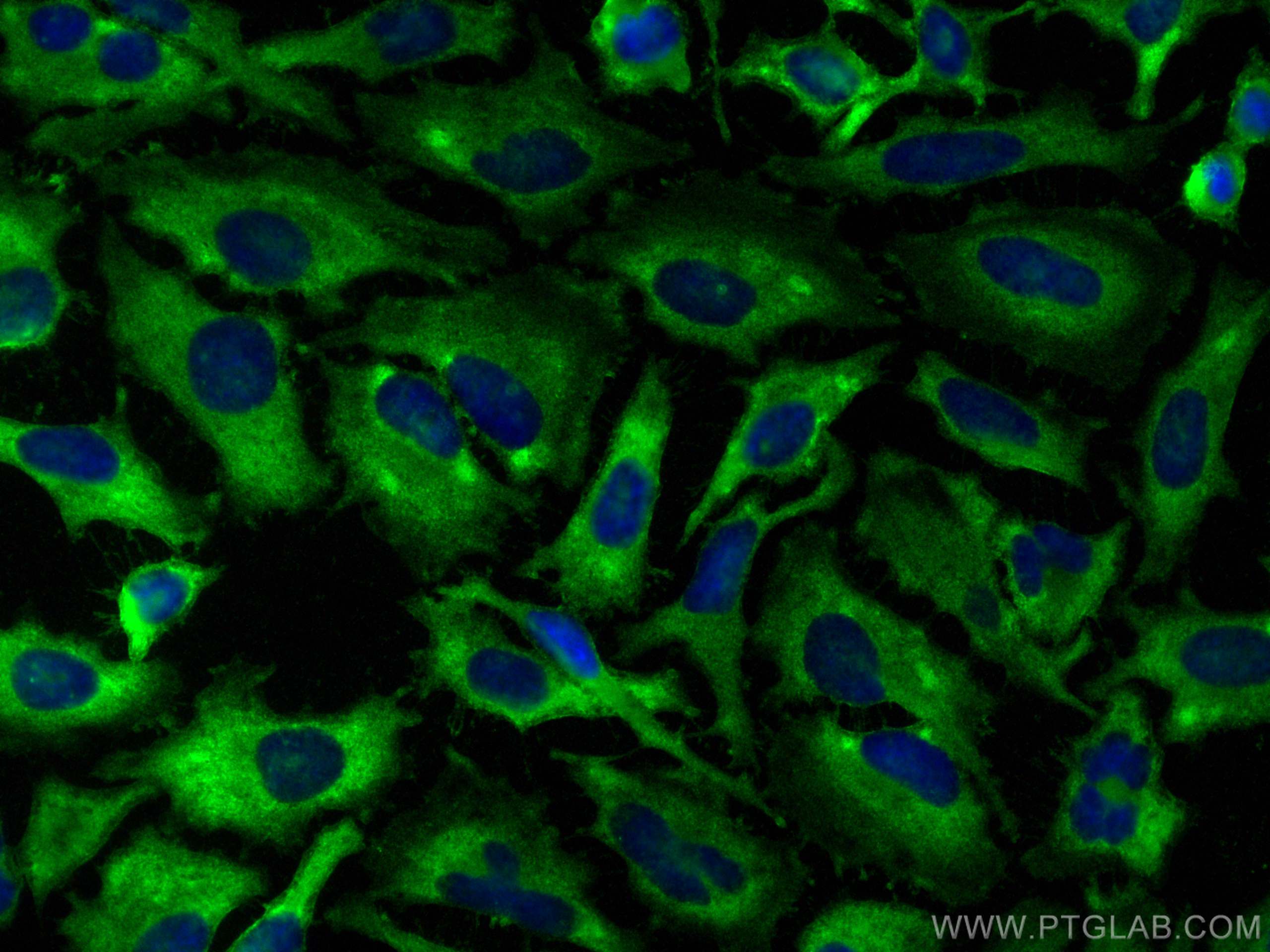 Immunofluorescence (IF) / fluorescent staining of HeLa cells using Annexin V Polyclonal antibody (11060-1-AP)