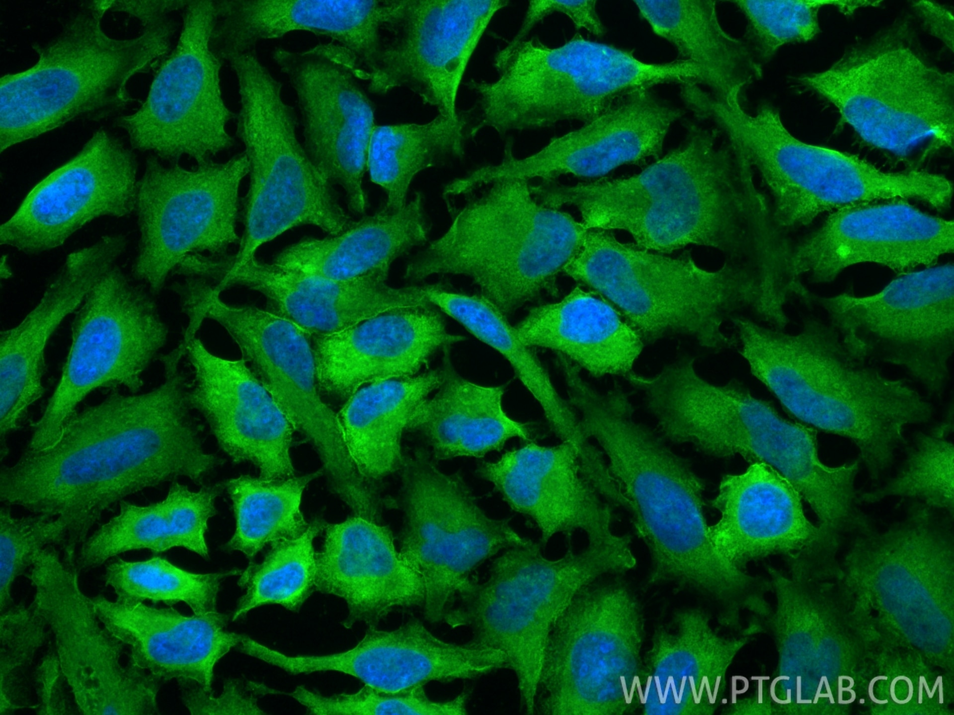Immunofluorescence (IF) / fluorescent staining of HeLa cells using Annexin V Polyclonal antibody (11060-1-AP)