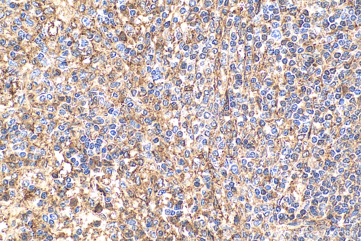 Immunohistochemistry (IHC) staining of human spleen tissue using Annexin V Polyclonal antibody (11060-1-AP)