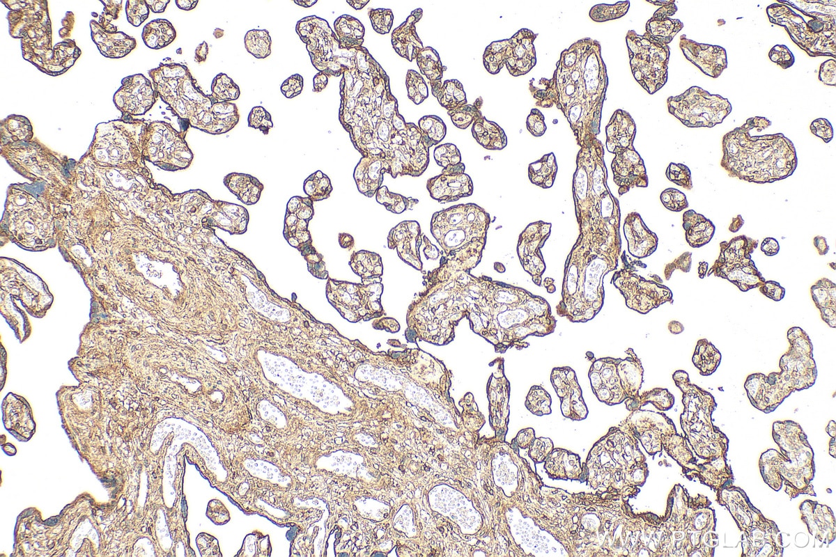 Immunohistochemistry (IHC) staining of human placenta tissue using Annexin V Polyclonal antibody (11060-1-AP)