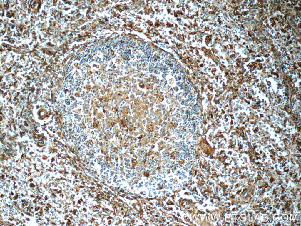 Immunohistochemistry (IHC) staining of human spleen tissue using Annexin V Polyclonal antibody (11060-1-AP)
