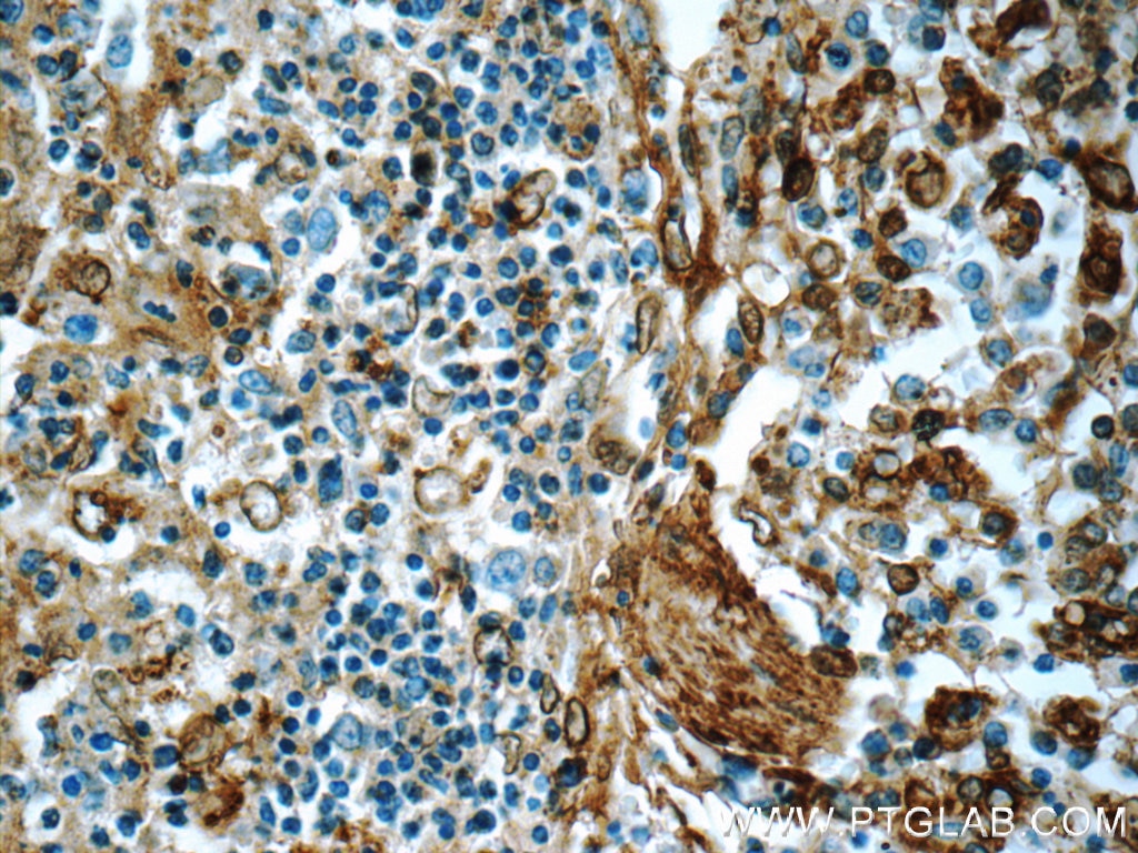 Immunohistochemistry (IHC) staining of human spleen tissue using Annexin V Polyclonal antibody (11060-1-AP)