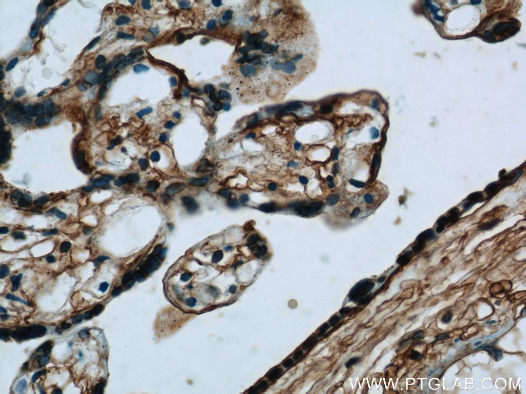 Immunohistochemistry (IHC) staining of human placenta tissue using Annexin V Polyclonal antibody (11060-1-AP)