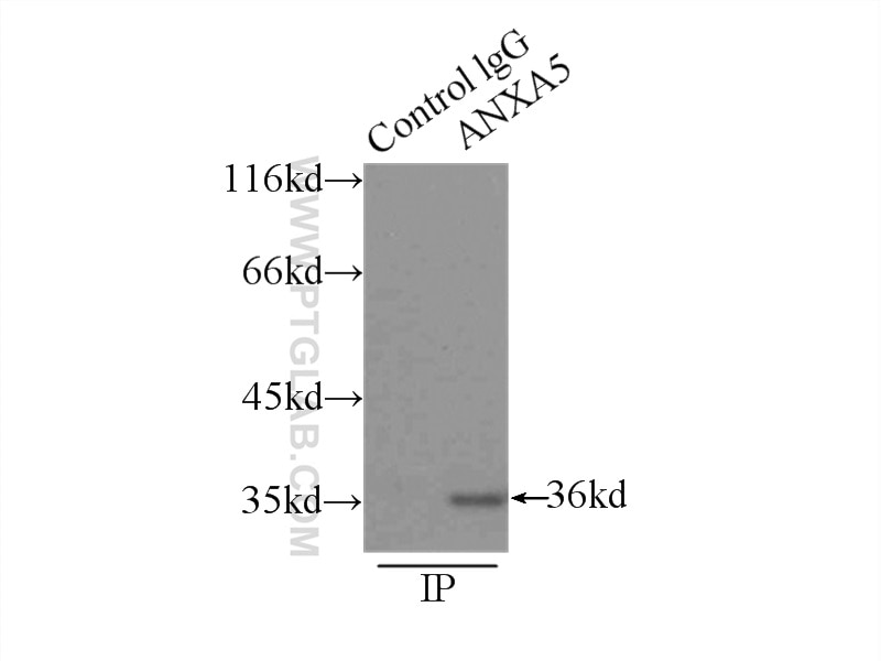 Immunoprecipitation (IP) experiment of HeLa cells using Annexin V Polyclonal antibody (11060-1-AP)