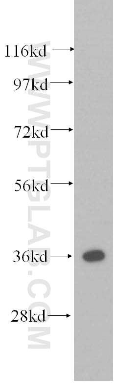 Western Blot (WB) analysis of human lung tissue using Annexin V Polyclonal antibody (11060-1-AP)