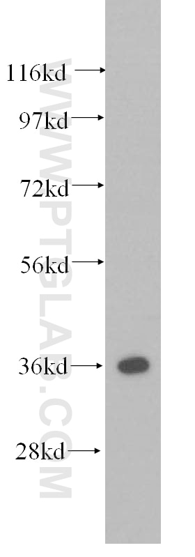 WB analysis of human lung using 11060-1-AP