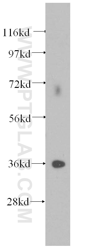 Western Blot (WB) analysis of human heart tissue using Annexin V Polyclonal antibody (11060-1-AP)