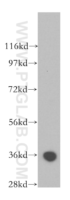 Western Blot (WB) analysis of human placenta tissue using Annexin V Polyclonal antibody (11060-1-AP)