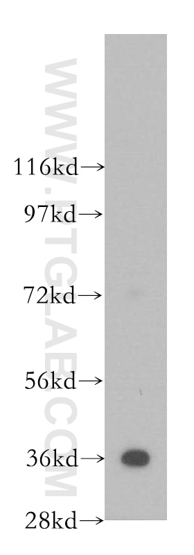 WB analysis of human skeletal muscle using 11060-1-AP