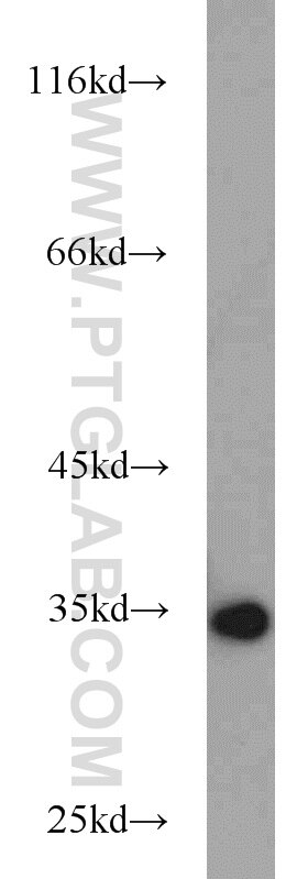 Annexin V Polyclonal antibody