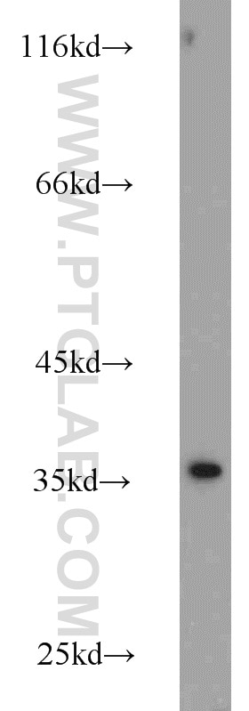Western Blot (WB) analysis of A431 cells using Annexin V Polyclonal antibody (11060-1-AP)