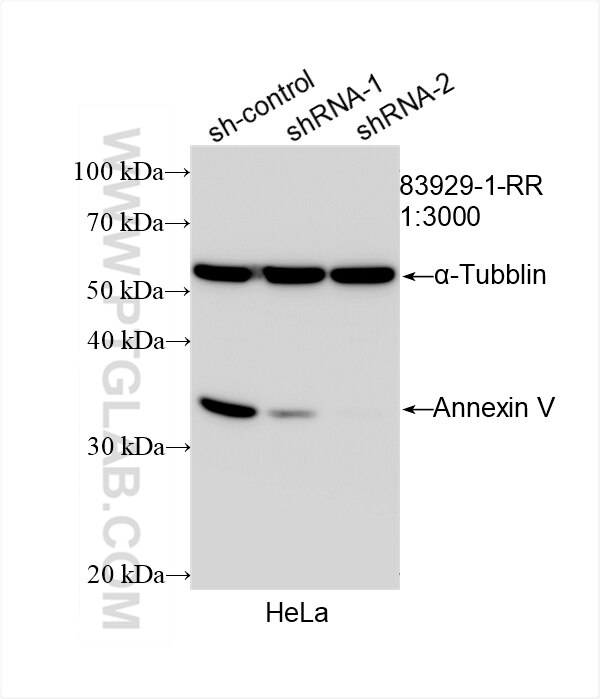 Western Blot (WB) analysis of HeLa cells using Annexin V Recombinant antibody (83929-1-RR)
