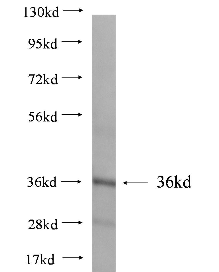 ANXA5 fusion protein Ag1538 SDS-PAGE