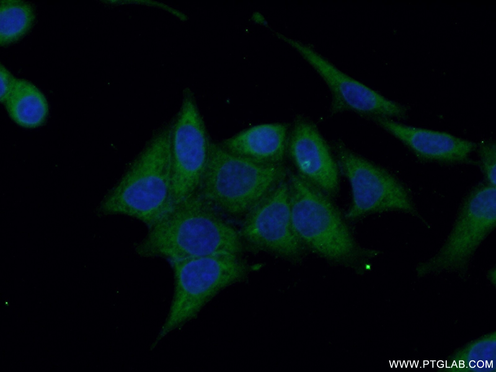 Immunofluorescence (IF) / fluorescent staining of HeLa cells using Annexin VI Polyclonal antibody (12542-1-AP)