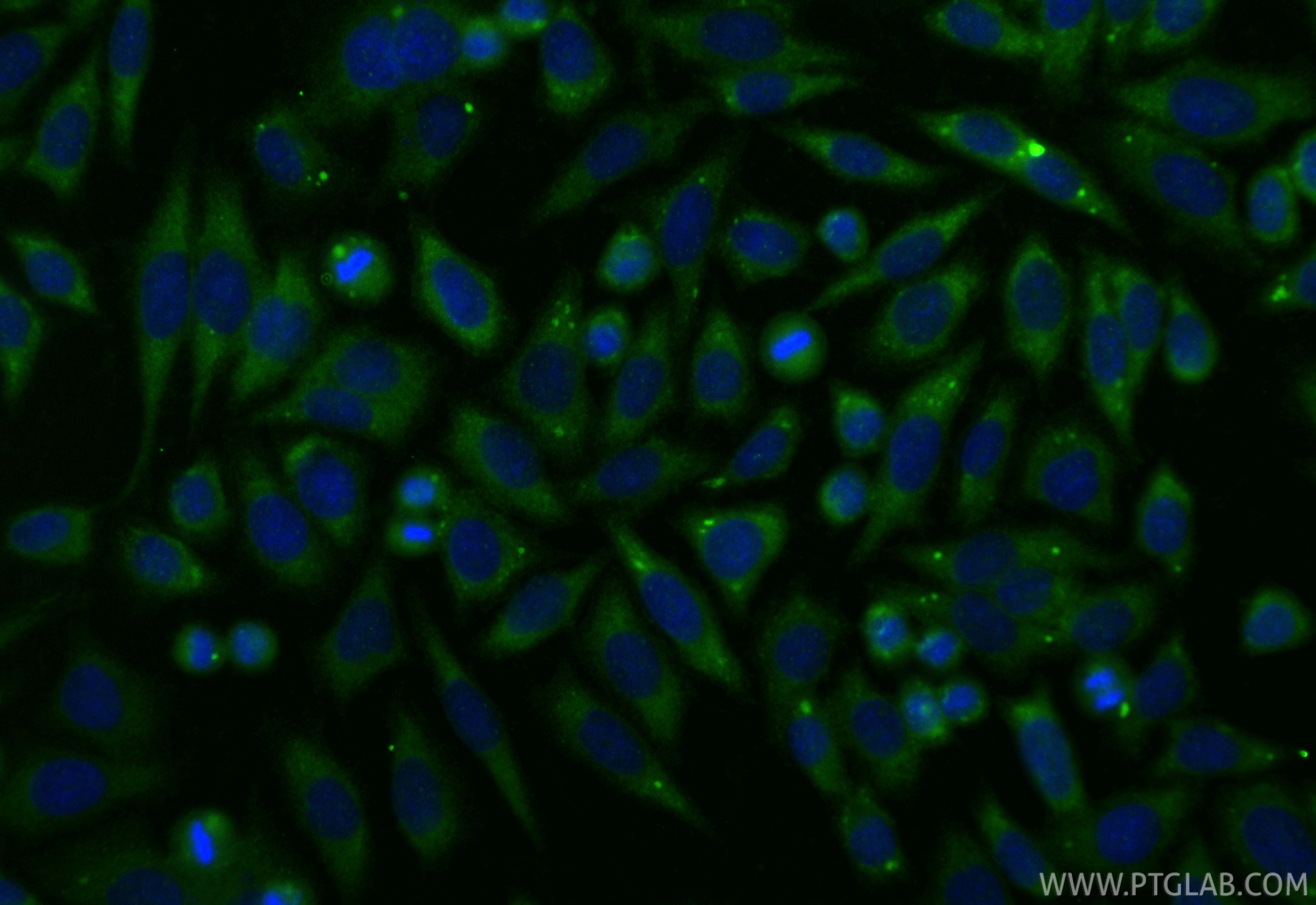 Immunofluorescence (IF) / fluorescent staining of HepG2 cells using Annexin VI Polyclonal antibody (12542-1-AP)