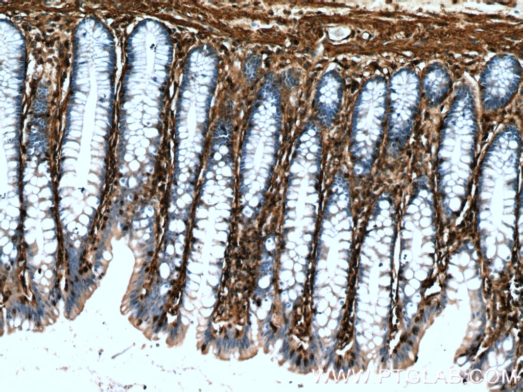 Immunohistochemistry (IHC) staining of human colon tissue using Annexin VI Polyclonal antibody (12542-1-AP)