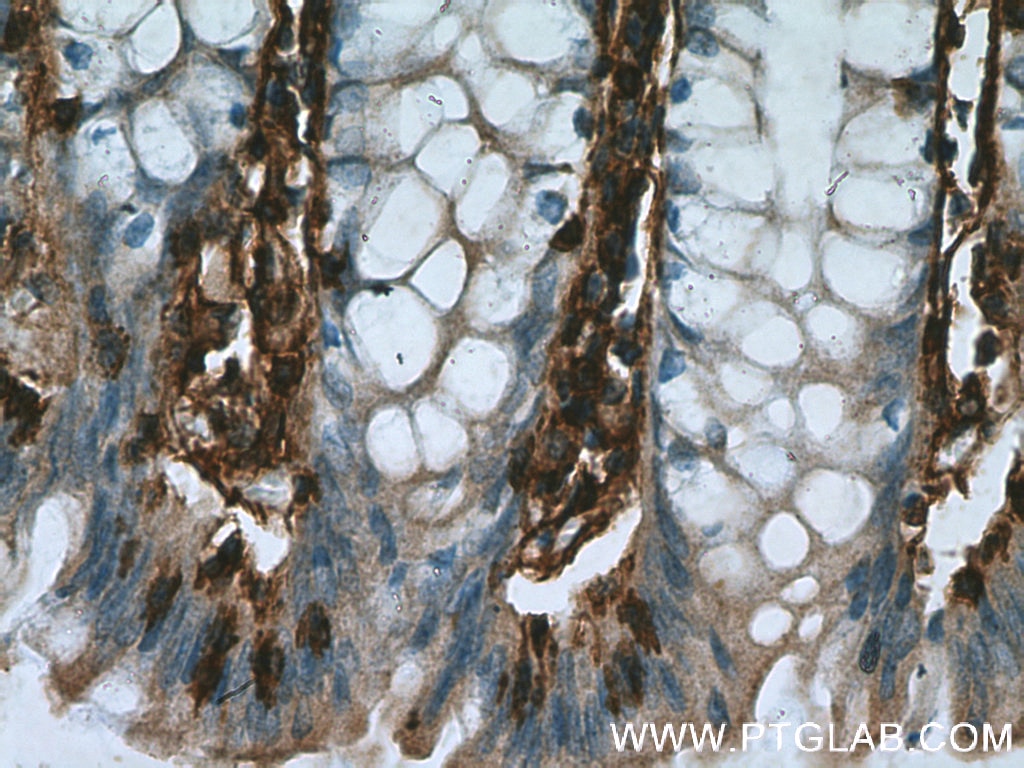 Immunohistochemistry (IHC) staining of human colon tissue using Annexin VI Polyclonal antibody (12542-1-AP)